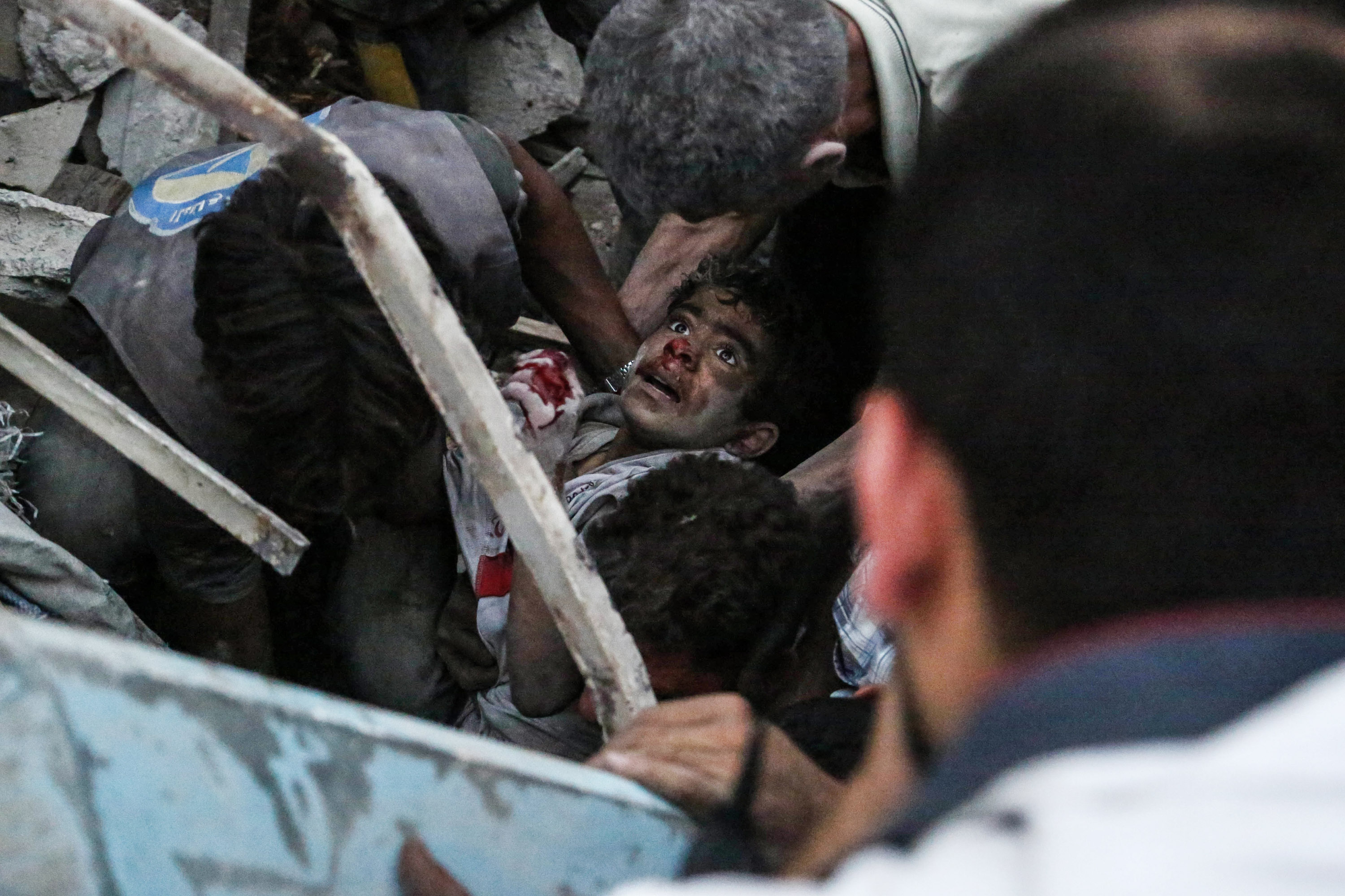 Syrians evacuate an injured boy from rubble following a reported air strike on a rebel-held town of Douma, northeast of the capital Damascus on June 16, 2015.
Nearly every day, Syria's air force drops barrel bombs -- containers packed with crude explosives and shrapnel -- on areas wrested from government control by rebels.  / AFP PHOTO / SAMEER AL-DOUMY